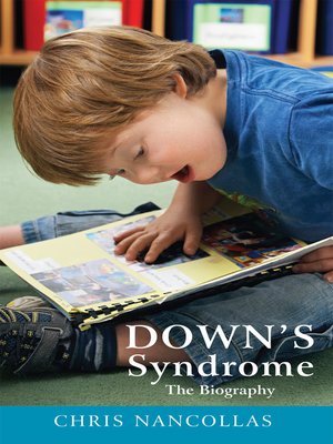 cover image of Down's Syndrome